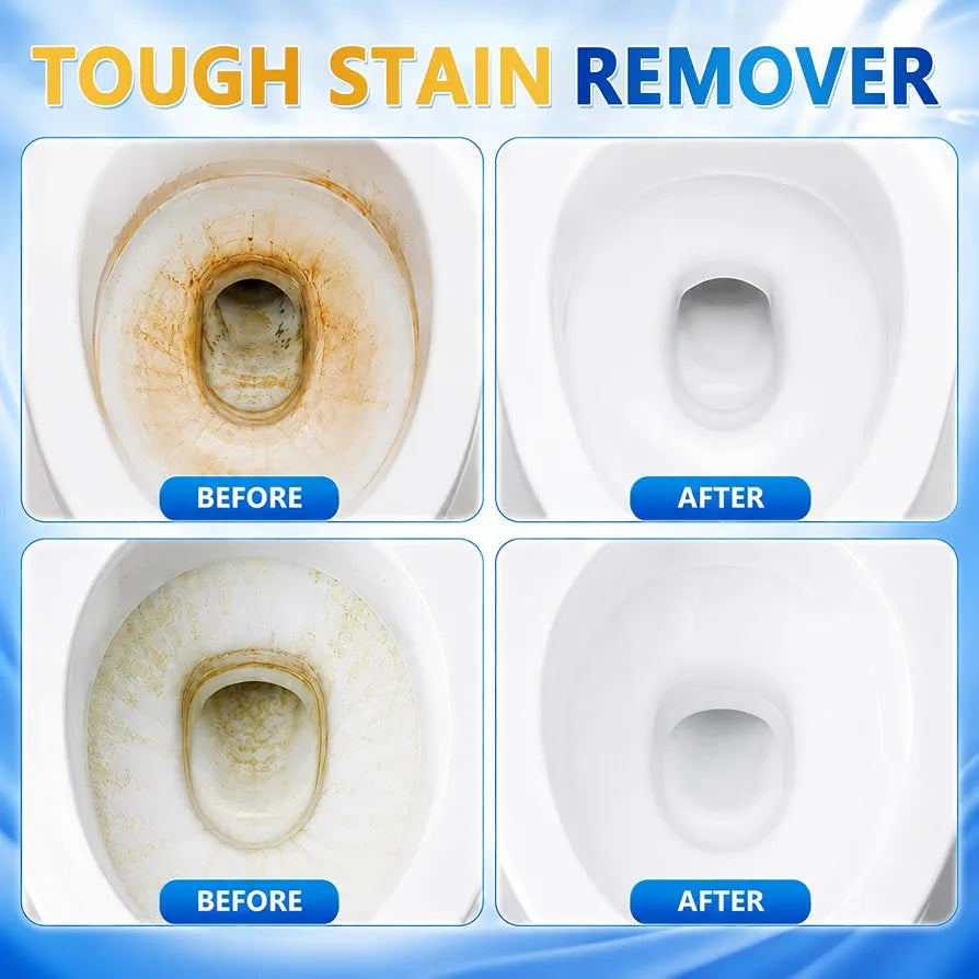 Bondtech Toilet Bowl Cleaner Tablets, 24 Pcs Heavy Duty Toilet Cleaner Tablets, Removes Tough Stains, Prevents Clogging, Protects Glaze for Cleaning Toilet, Bathroom Tank(8.8 Ounce (Pack of 1))